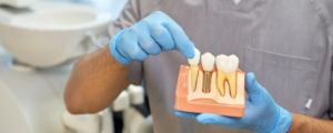 Dental Implant Services