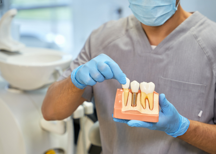 Dental Implant Services
