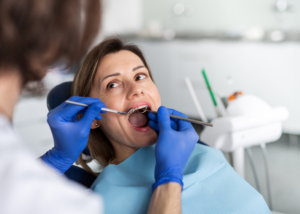 Dental Check ups