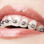 Dentist Bundoora