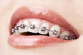 Orthodontist Bundoora