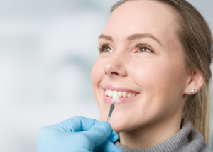 Dental Veneers